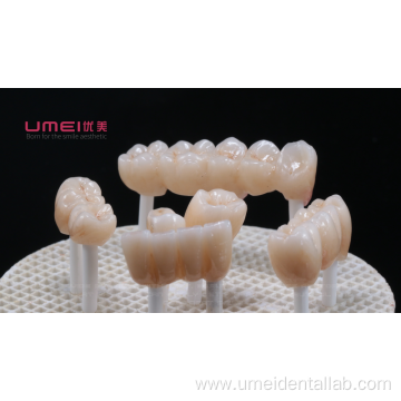 Zirconia bridge